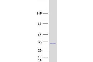 Validation with Western Blot