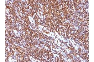 Formalin-fixed, paraffin-embedded human tonsil stained with SUMO-1 antibody (SUMO1/1188) (SUMO1 anticorps)