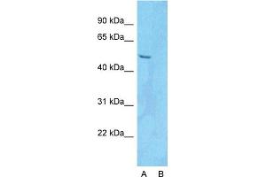 Host:  Rabbit  Target Name:  PDLIM5  Sample Type:  HepG2  Lane A:  Primary Antibody  Lane B:  Primary Antibody + Blocking Peptide  Primary Antibody Concentration:  1ug/ml  Peptide Concentration:  5.