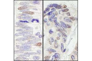 Immunohistochemistry (IHC) image for anti-Pescadillo Homolog 1 (PES1) (AA 25-75) antibody (ABIN7453508)