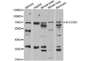 Western blot analysis of extracts of various cell lines, using SLC23A2 antibody. (SLC23A2 anticorps)