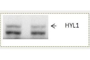 Western Blotting (WB) image for anti-Epoxide Hydrolase 1, Microsomal (Xenobiotic) (EPHX1) antibody (ABIN334544) (EPHX1 anticorps)