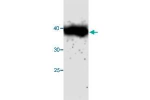 Western blot analysis in CTSH recombinant protein with CTSH monoclonal antibody, clone 69s45  at 1 : 1000 dilution. (Cathepsin H anticorps)