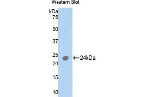 Detection of Recombinant TNNI1, Human using Polyclonal Antibody to Troponin I Type 1, Slow Skeletal (TNNI1)