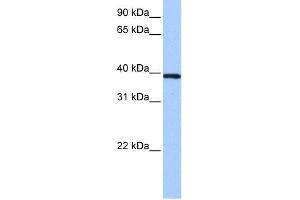 WB Suggested Anti-ZNF618 Antibody Titration:  0. (ZNF618 anticorps  (N-Term))