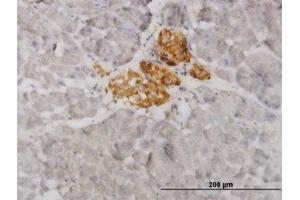 Image no. 1 for anti-Vesicle-Associated Membrane Protein 1 (Synaptobrevin 1) (VAMP1) (AA 28-97) antibody (ABIN598952) (VAMP1 anticorps  (AA 28-97))