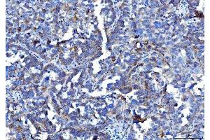 IHC analysis of Poliovirus Receptor/PVR using anti-Poliovirus Receptor/PVR antibody (ABIN7601072). (Poliovirus Receptor anticorps  (AA 28-331))