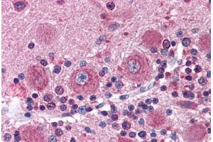 Human Brain, Cerebellum (formalin-fixed, paraffin-embedded) stained with DISC1 antibody ABIN337351 at 10 ug/ml followed by biotinylated goat anti-rabbit IgG secondary antibody ABIN481713, alkaline phosphatase-streptavidin and chromogen. (DISC1 anticorps  (C-Term))