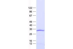 Validation with Western Blot