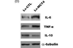 MCT4 modulates various inflammatory cytokines expression. (IL-10 anticorps  (AA 19-178))