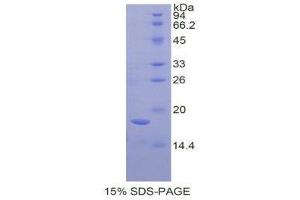 SDS-PAGE (SDS) image for Amelogenin, X-Linked (AMELX) (AA 49-187) protein (His tag) (ABIN2120565) (AMELX Protein (AA 49-187) (His tag))