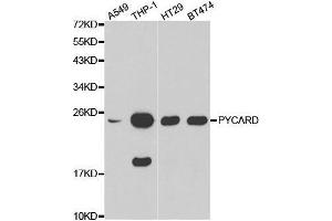 Western blot analysis of extracts of various cell lines, using PYCARD antibody. (PYCARD anticorps  (AA 50-195))