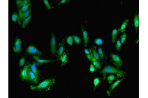 Immunofluorescent analysis of Hela cells using ABIN7152694 at dilution of 1:100 and Alexa Fluor 488-congugated AffiniPure Goat Anti-Rabbit IgG(H+L) (FARP2 anticorps  (AA 261-550))