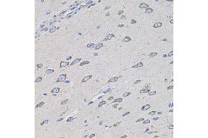Immunohistochemistry of paraffin-embedded rat brain using TMC1 antibody (ABIN5996250) at dilution of 1/100 (40x lens). (TMC1 anticorps)