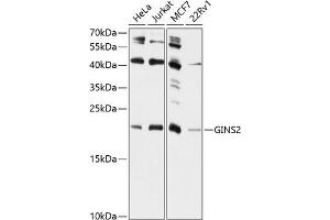 Western blot analysis of extracts of various cell lines, using GINS2 antibody (ABIN6131700, ABIN6141087, ABIN6141088 and ABIN6224916) at 1:1000 dilution.