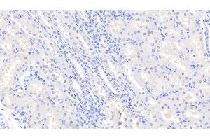 Detection of LOX1 in Bovine Kidney Tissue using Polyclonal Antibody to Lectin Like Oxidized Low Density Lipoprotein Receptor 1 (LOX1) (OLR1 anticorps  (AA 57-270))