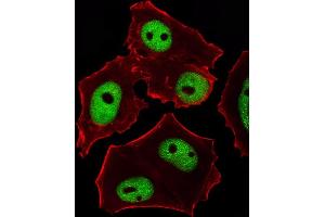 Fluorescent image of MCF-7 cells stained with GATA3 Antibody (Center) (ABIN1944795 and ABIN2838499). (GATA3 anticorps  (AA 1-444))