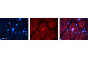 Rabbit Anti-BUB3 Antibody Catalog Number: ARP58599_P050 Formalin Fixed Paraffin Embedded Tissue: Human heart Tissue Observed Staining: Nucleus Primary Antibody Concentration: 1:100 Other Working Concentrations: N/A Secondary Antibody: Donkey anti-Rabbit-Cy3 Secondary Antibody Concentration: 1:200 Magnification: 20X Exposure Time: 0.