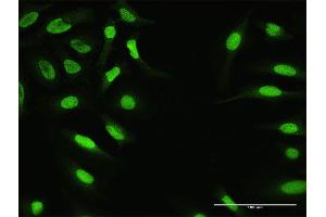 Immunofluorescence of purified MaxPab antibody to ZNF124 on HeLa cell.
