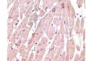 Immunohistochemistry (IHC) image for anti-Cardiac Troponin I (TNNI3) (truncated) antibody (ABIN2464041)
