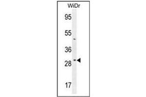Western blot analysis of RPS6 in WiDr cell line lysates (35ug/lane) using RPS6 Antibody(Ser240/244) Cat.