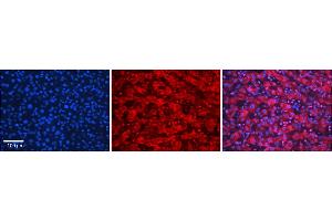 Rabbit Anti-SLC26A3 Antibody  Catalog Number: ARP31608_P050 Formalin Fixed Paraffin Embedded Tissue: Human Adult liver  Observed Staining: Cytoplasmic,Nuclear Primary Antibody Concentration: 1:600 Secondary Antibody: Donkey anti-Rabbit-Cy2/3 Secondary Antibody Concentration: 1:200 Magnification: 20X Exposure Time: 0.