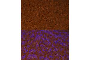 Immunofluorescence analysis of mouse brain using Calmodulin 1/2/3 Rabbit mAb (ABIN1680490, ABIN3019260, ABIN3019261 and ABIN7101739) at dilution of 1:100 (40x lens).