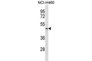 CHST6 Antibody (C-term) western blot analysis in NCI-H460 cell line lysates (35µg/lane). (CHST6 anticorps  (C-Term))