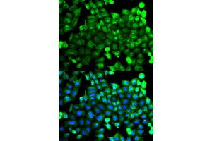 Immunofluorescence analysis of A549 cell using NCALD antibody.