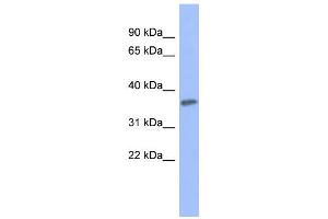 WB Suggested Anti-PRKCG Antibody Titration: 0. (PKC gamma anticorps  (Middle Region))