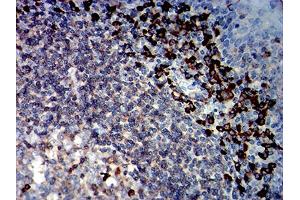 Immunohistochemical analysis of paraffin-embedded tonsil tissues using CD45R mouse mAb with DAB staining.