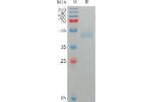 Human SIRPG Protein, His Tag on SDS-PAGE under reducing condition.