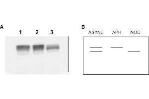 Image no. 1 for anti-Minichromosome Maintenance Complex Component 2 (MCM2) (AA 21-31) antibody (ABIN401335) (MCM2 anticorps  (AA 21-31))