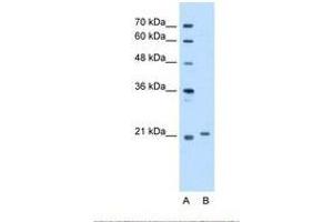 Image no. 1 for anti-Titin-Cap (Telethonin) (TCAP) (C-Term) antibody (ABIN321410) (TCAP anticorps  (C-Term))