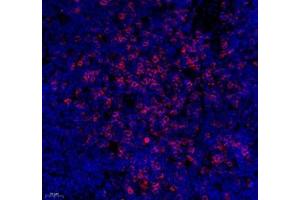 Immunofluorescence of paraffin embedded mouse spleen using CD3 (ABIN7073386) at dilution of 1: 500 (400x lens)