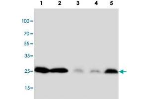 Western blot analysis of tissue and cell extracts with PTN polyclonal antibody . (Pleiotrophin anticorps  (C-Term))