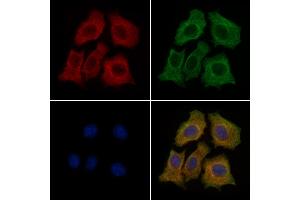 ABIN6260006 and ABIN6279136 staining HepG2 cells by IF/ICC. (AQP11 anticorps  (Internal Region))