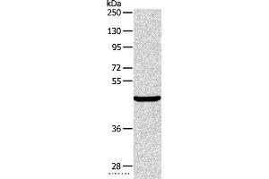 Western blot analysis of Mouse pancreas tissue, using ALKBH1 Polyclonal Antibody at dilution of 1:400 (ALKBH1 anticorps)