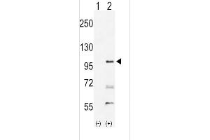 Western blot analysis of EPHA2 (arrow) using rabbit polyclonal hEPHA2-T45 (ABIN391885 and ABIN2841705).