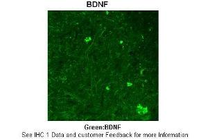Sample Type :  Rhesus macaque spinal cord  Primary Antibody Dilution :  1:300  Secondary Antibody :  Donkey anti Rabbit 488  Secondary Antibody Dilution :  1:500  Color/Signal Descriptions :  Green: BDNF  Gene Name :  BDNF  Submitted by :  Timur Mavlyutov, Ph. (BDNF anticorps  (Middle Region))