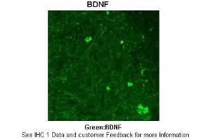 Sample Type :  Rhesus macaque spinal cord  Primary Antibody Dilution :  1:300  Secondary Antibody :  Donkey anti Rabbit 488  Secondary Antibody Dilution :  1:500  Color/Signal Descriptions :  Green: BDNF  Gene Name :  BDNF  Submitted by :  Timur Mavlyutov, Ph.