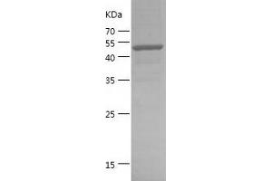 Western Blotting (WB) image for TGF-beta Activated Kinase 1/MAP3K7 Binding Protein 3 (TAB3) (AA 521-712) protein (GST tag) (ABIN7125347)