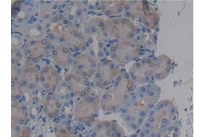 Detection of BPI in Mouse Kidney Tissue using Polyclonal Antibody to Bactericidal/Permeability Increasing Protein (BPI)