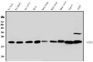 Western blot analysis of HP1 gamma using anti-HP1 gamma antibody (ABIN5693033). (CBX3 anticorps  (AA 2-183))