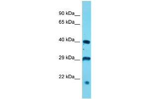 Host: Rabbit  Target Name: Usp12  Sample Tissue: Mouse Stomach lysates  Antibody Dilution: 1. (USP12 anticorps  (N-Term))