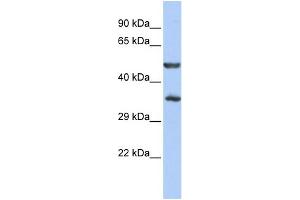 WB Suggested Anti-ZNF414 Antibody Titration:  0. (ZNF414 anticorps  (N-Term))
