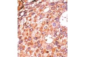 Image no. 1 for anti-E2F Transcription Factor 1 (E2F1) (pSer337) antibody (ABIN358119)