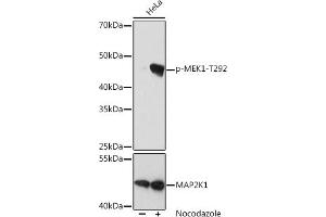 Western blot analysis of extracts of HeLa cells, using Phospho-MEK1-T292 pAb (ABIN7268635) at 1:1000 dilution or MK1 antibody (ABIN6134386, ABIN6143481, ABIN6143482 and ABIN7101408). (MEK1 anticorps  (pThr292))