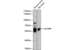 Western blot analysis of extracts of various cell lines, using C antibody (ABIN6130024, ABIN6137821, ABIN6137822 and ABIN6224970) at 1:1000 dilution. (CACNB4 anticorps  (AA 401-520))