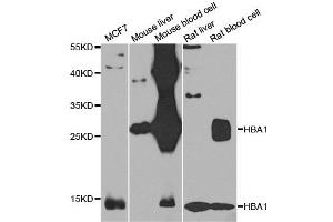 Western blot analysis of extracts of various cell lines, using HBA1 antibody. (HBA1 anticorps)